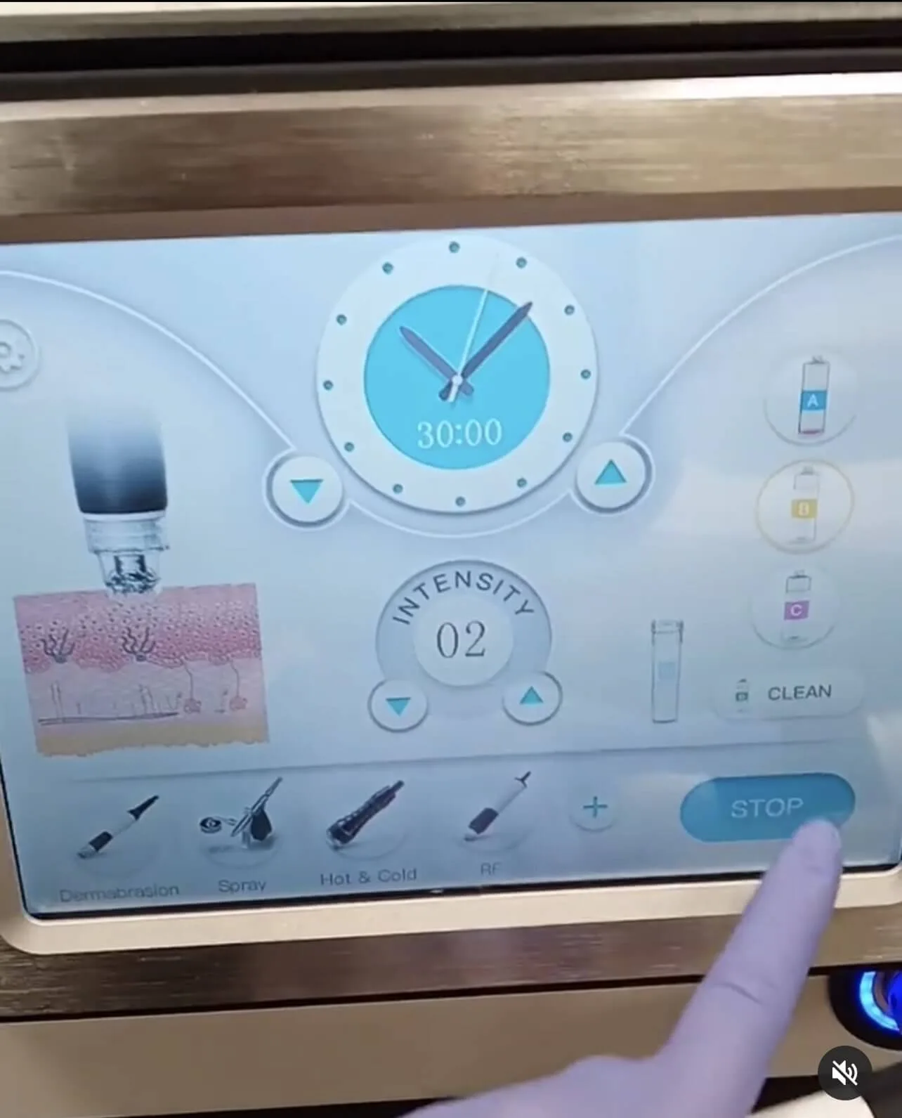 oczyszczanie wodorowe twarzy, oczyszczanie wodorowe skóry, trądzik i zaskórniki, całoroczny zabieg pielęgnacyjny