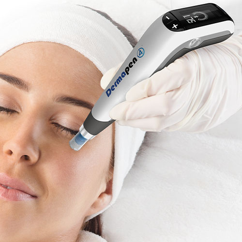 mezoterapia mikroigłowa Łódź, Dermapen 4.0 Łódź, czy można wykonywać mezoterapię mikroigłową latem, nakłuwanie skóry latem, zabiegi na twarz latem, rewitalizacja skóry latem, odmładzanie skóry Łódź, mezoterapia nawilżająca, regeneracja skóry latem, ochrona skóry po mezoterapii