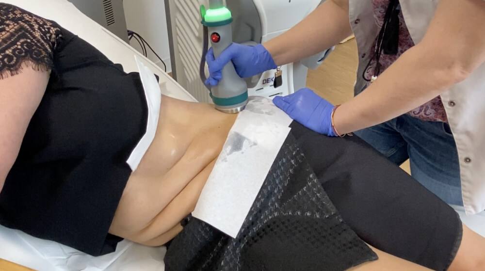 modelowanie sylwetki mikrofalami, modelowanie sylwetki, modelowanie ciała, celulit, medycyna estetyczna, rozstępy, liposukcja, laserowe modelowanie sylwetki, ONDA modelowanie sylwetki