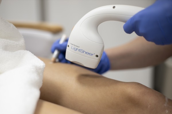 depilacja laserowa, LightSheer Desire, usuwanie owłosienia, laserowa depilacja, gładka skóra, skuteczna depilacja