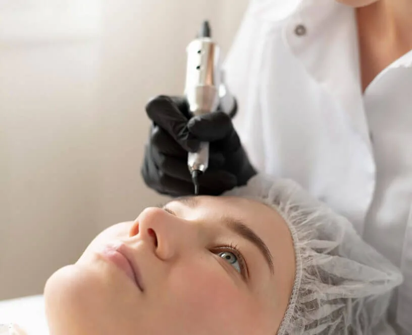 laserowe usuwanie makijażu permanentnego, usuwanie makijażu permanentnego