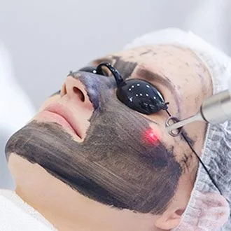 laserowy peeling weglowy