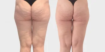 modelowanie sylwetki onda posladki