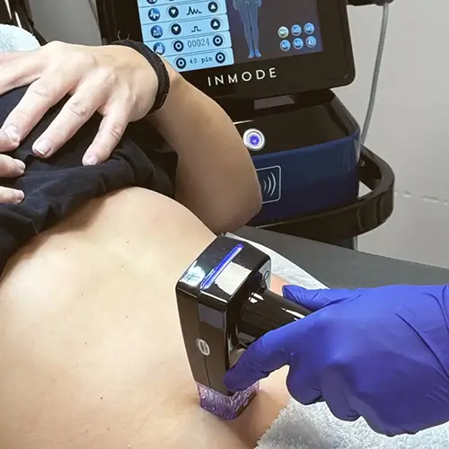 Zabiegi Hi-Tech Pro Laser Clinic, Lodz